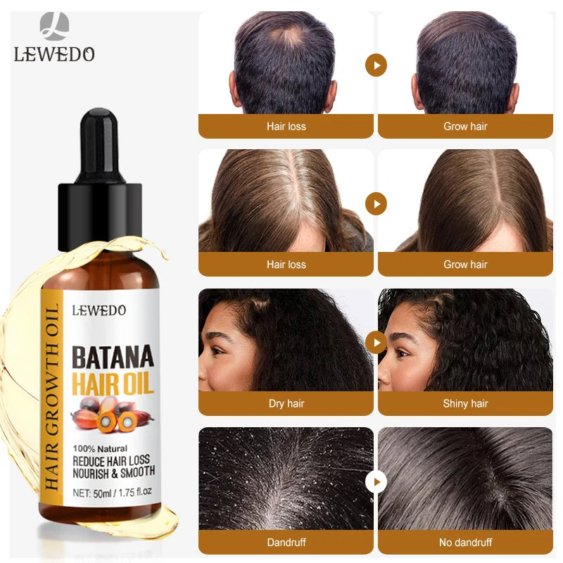 Oil Beauty Hair Care Anti-Hair Loss Essence Natural Repair Damaged Hair